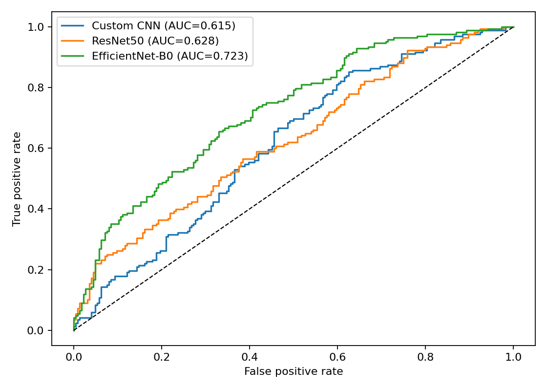 Study B ROC comparison for transfer learning mammography models