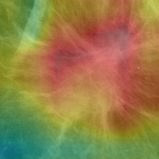 CBIS-DDSM mammography full processed image with Grad-CAM coarse attention overlay
